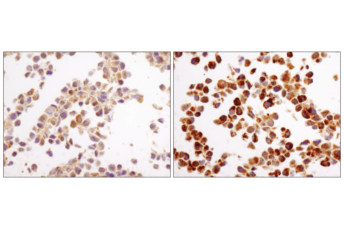 Immunohistochemistry Image 3: LC3A/B (D3U4C) XP<sup>®</sup> Rabbit mAb