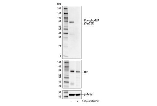 Western Blotting Image 2: Phospho-RIP (Ser321) (E9K2A) Rabbit Monoclonal Antibody (BSA and Azide Free)