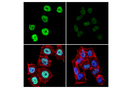Immunofluorescence Image 1: MEF2D (E6H7N) Rabbit Monoclonal Antibody