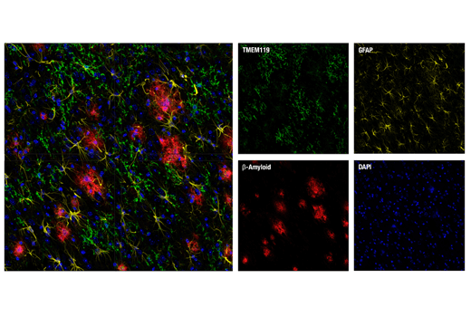 Immunofluorescence Image 2: TMEM119 (E3E1O) Rabbit Monoclonal Antibody (BSA and Azide Free)