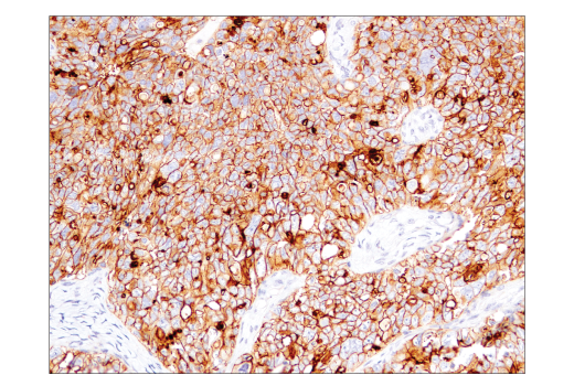 Immunohistochemistry Image 3: CD47 (D3O7P) Rabbit Monoclonal Antibody (BSA and Azide Free)