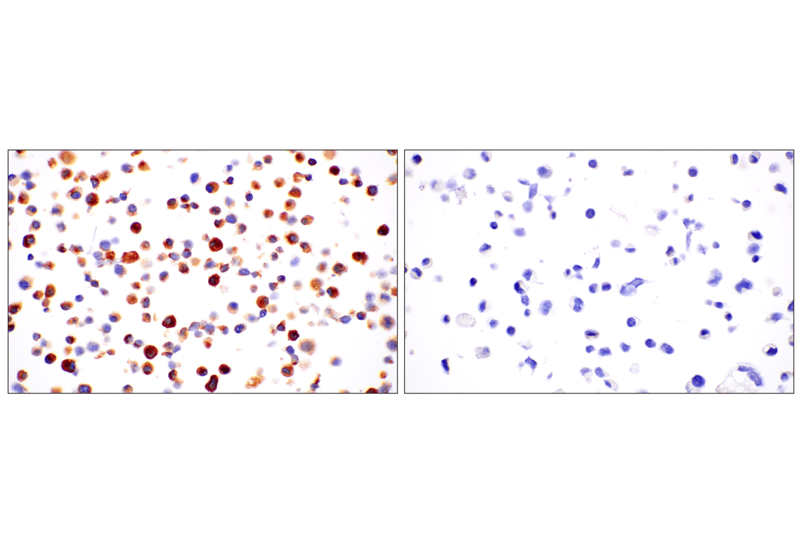 Immunohistochemistry Image 7: C1QB (E3U6X) Rabbit Monoclonal Antibody