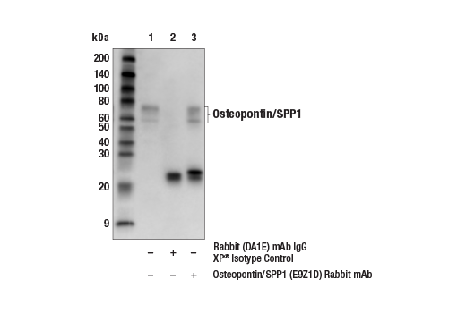 Immunoprecipitation Image 1: Osteopontin/SPP1 (E9Z1D) Rabbit Monoclonal Antibody