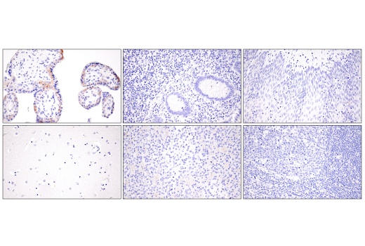 Immunohistochemistry Image 3: Claudin-6 (E7U2O) XP<sup>®</sup> Rabbit mAb