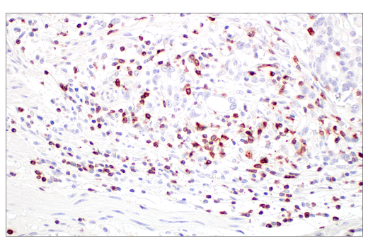 Immunohistochemistry Image 7: CD7 (E4G1Q) Rabbit Monoclonal Antibody (BSA and Azide Free)