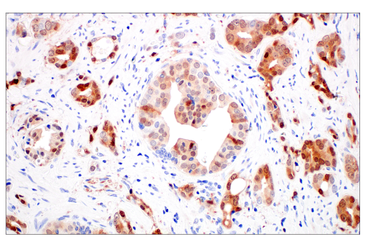 Immunohistochemistry Image 3: p16 INK4A (BC42) Mouse Monoclonal Antibody