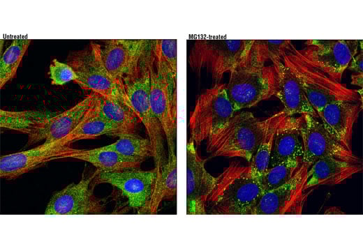 Immunofluorescence Image 1: FXR2 (D85D6) Rabbit Monoclonal Antibody