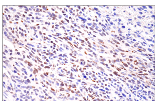 Immunohistochemistry Image 6: HIF-1α (E1V6A) Rabbit mAb (BSA and Azide Free)