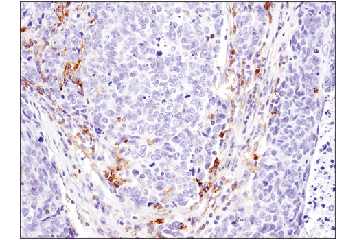 Immunohistochemistry Image 3: MX1 (D3W7I) Rabbit Monoclonal Antibody