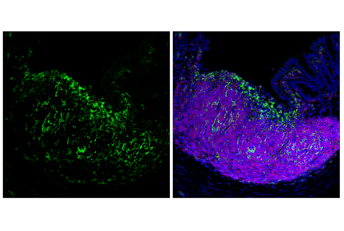Immunofluorescence Image 3: Dectin-1/ Clec7a (E3P5W) Rabbit Monoclonal Antibody (BSA and Azide Free)