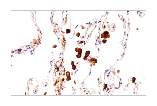 undefined Image 31: Ferroptosis Antibody Sampler Kit