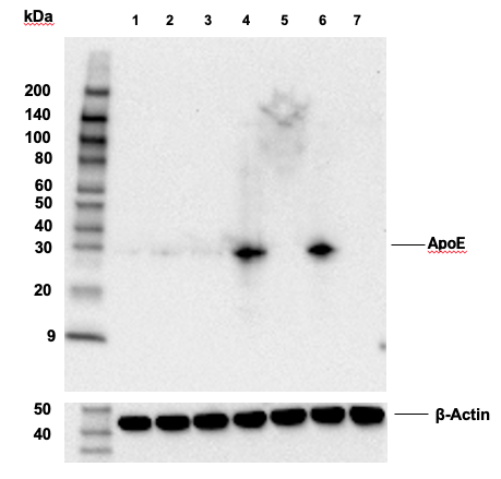 Western Blotting Image 2: ApoE (E7X2A) Rabbit Monoclonal Antibody