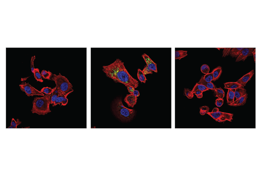 undefined Image 34: p62/KEAP1/NRF2 Pathway Antibody Sampler Kit