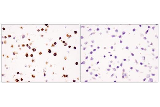 Immunohistochemistry Image 7: TIM-3 (D5D5R) Rabbit Monoclonal Antibody (BSA and Azide Free)
