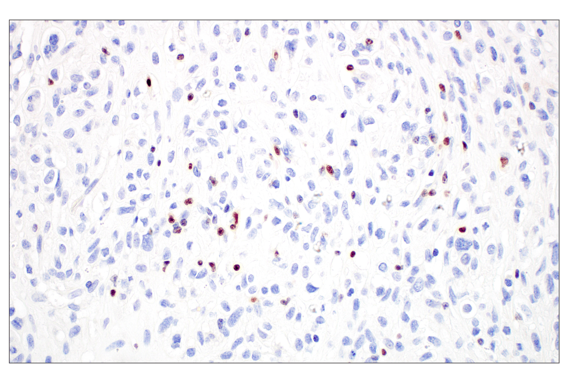 Immunohistochemistry Image 5: T-bet/TBX21 (E4I2K) Rabbit Monoclonal Antibody (BSA and Azide Free)