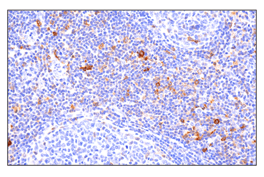 Immunohistochemistry Image 2: Phospho-SLP-76 (Ser376) (E3G9U) Rabbit Monoclonal Antibody (BSA and Azide Free)