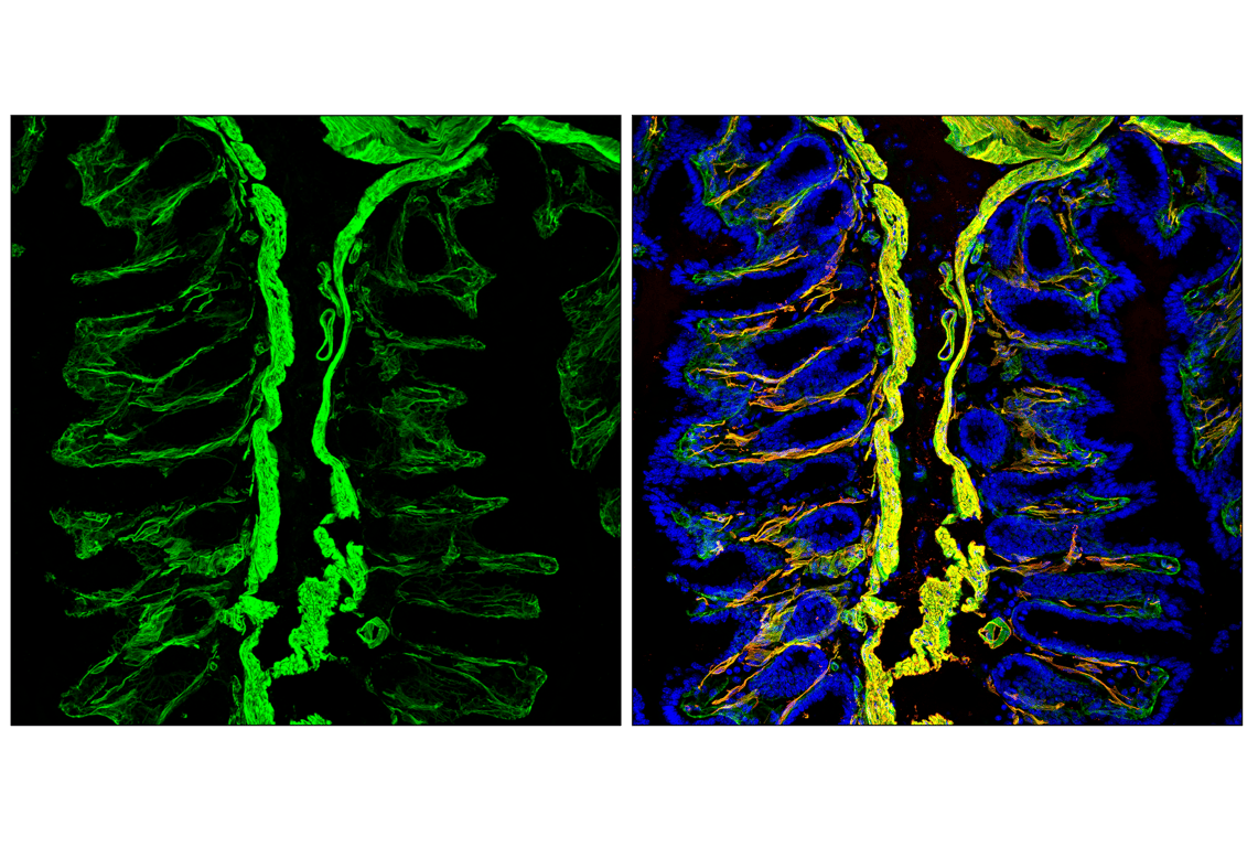 Immunofluorescence Image 4: Caldesmon-1 (D5C8D) Rabbit Monoclonal Antibody
