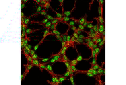 Immunofluorescence Image 1: SKAR alpha/beta (D65E8) Rabbit Monoclonal Antibody