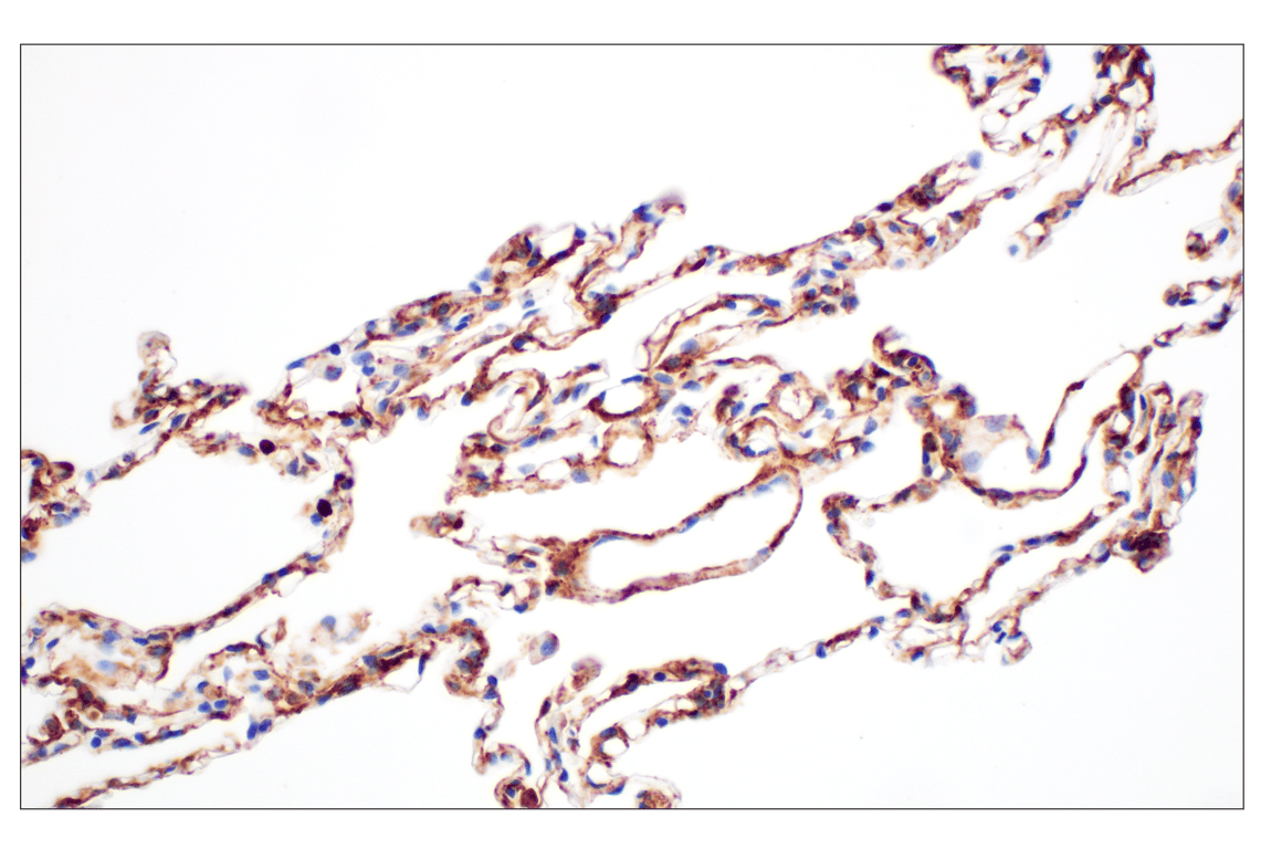 Immunohistochemistry Image 9: Hyaluronan Complete Tissue Staining Kit (HRP)