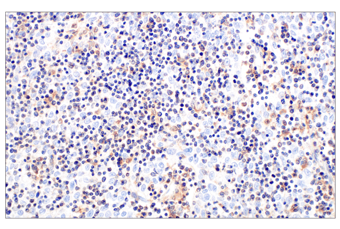 Immunohistochemistry Image 2: RhoA (67B9) Rabbit Monoclonal Antibody