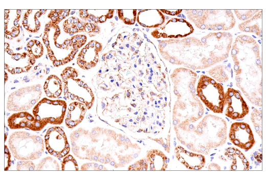 Immunohistochemistry Image 5: Cox2 (D5H5) Rabbit Monoclonal Antibody (BSA and Azide Free)
