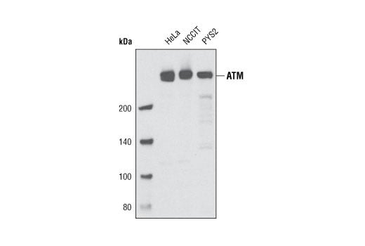 undefined Image 5: Double Strand Breaks (DSB) Repair Antibody Sampler Kit