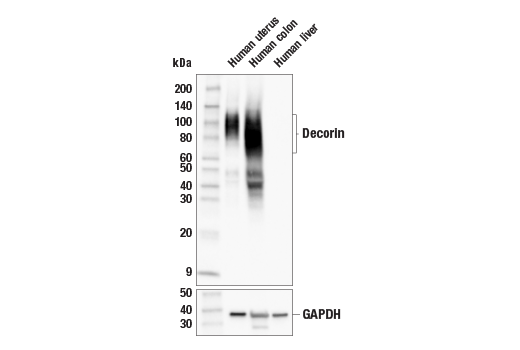 Western Blotting Image 1: Decorin (E2N2C) XP<sup>®</sup> Rabbit mAb