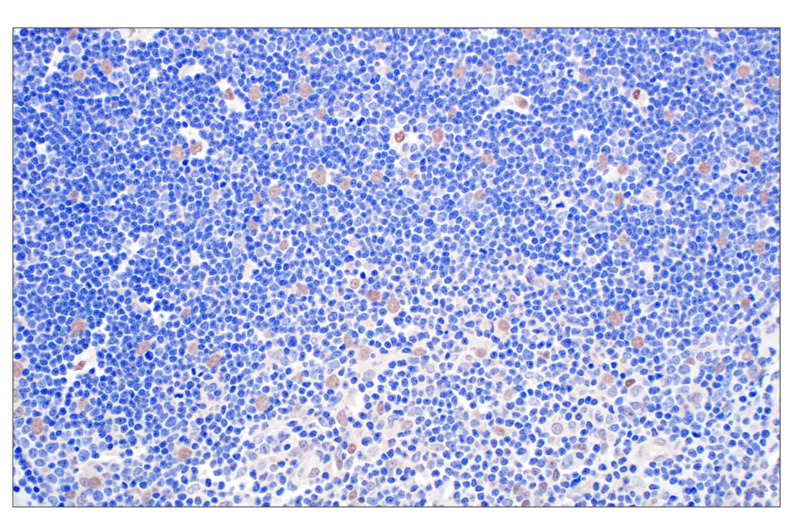 Immunohistochemistry Image 11: TFE3 (F3Z2Q) Rabbit Monoclonal Antibody