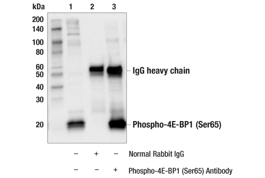 undefined Image 30: 4E-BP Antibody Sampler Kit
