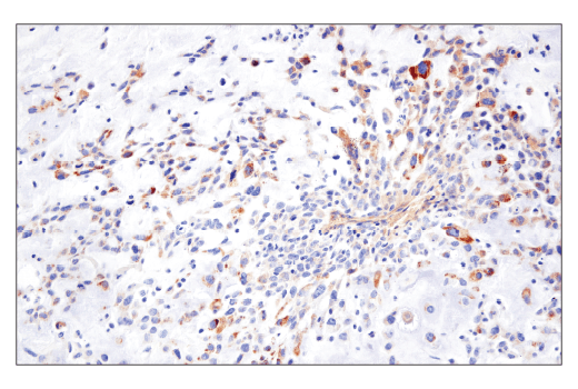 Immunohistochemistry Image 1: TMOD1 (E7E3A) Rabbit Monoclonal Antibody