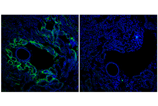 Immunofluorescence Image 1: Phospho-Paxillin (Tyr118) (E9U9F) Rabbit Monoclonal Antibody