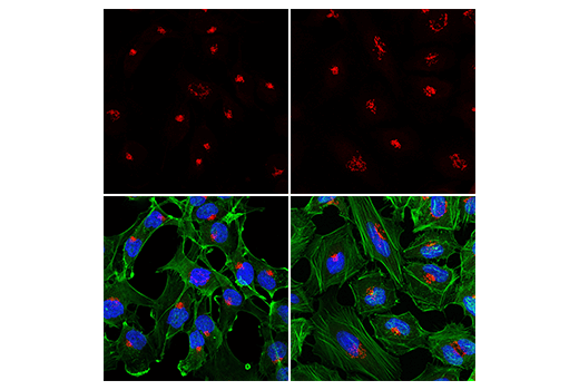 Immunofluorescence Image 1: GM130 (D6B1) XP<sup>®</sup> Rabbit mAb (Alexa Fluor<sup>®</sup> 647 Conjugate)
