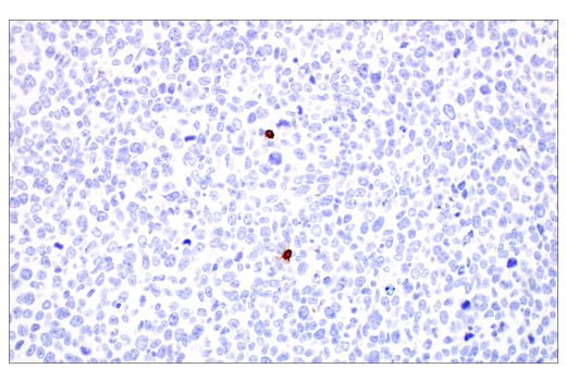 Immunohistochemistry Image 2: CD20 (E3N7O) Rabbit Monoclonal Antibody (BSA and Azide Free)