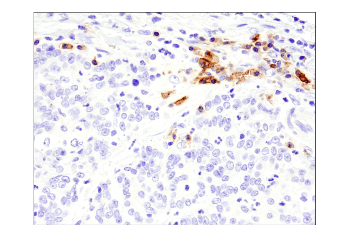 Immunohistochemistry Image 10: TNFRSF17/BCMA (E6D7B) Rabbit Monoclonal Antibody