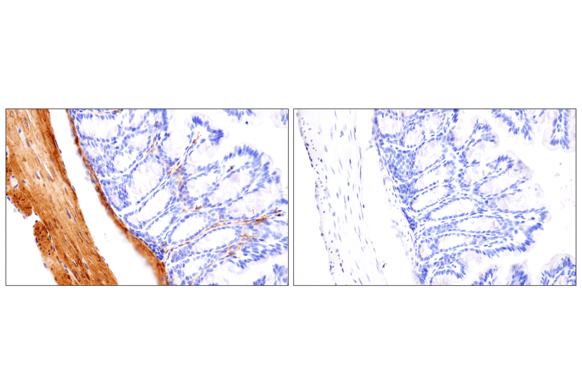 Immunohistochemistry Image 16: Desmin (F5V4I) Rabbit Monoclonal Antibody (BSA and Azide Free)