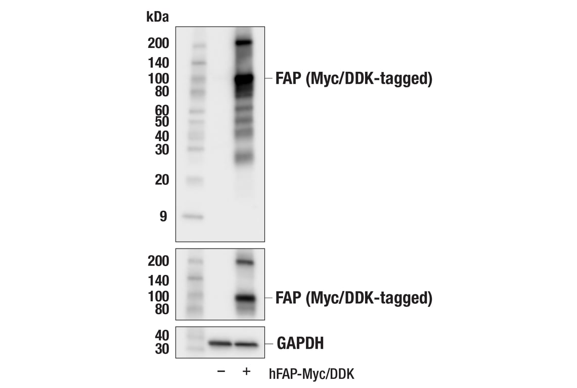 Western Blotting Image 2: FAP (F1A4G) Rabbit Monoclonal Antibody