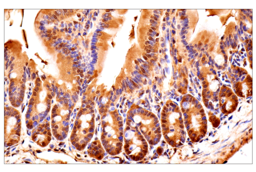 Immunohistochemistry Image 12: Ubiquitin (E6K4Y) Rabbit Monoclonal Antibody