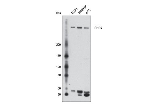 Western Blotting Image 1: CHD7 (D3F5) Rabbit mAb