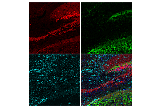 Immunofluorescence Image 3: Calretinin (E7R6O) Rabbit Monoclonal Antibody (BSA and Azide Free)