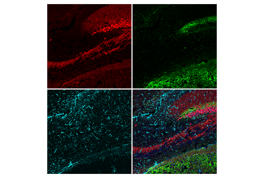 Immunofluorescence Image 3: Calretinin (E7R6O) XP<sup>®</sup> Rabbit mAb (BSA and Azide Free)