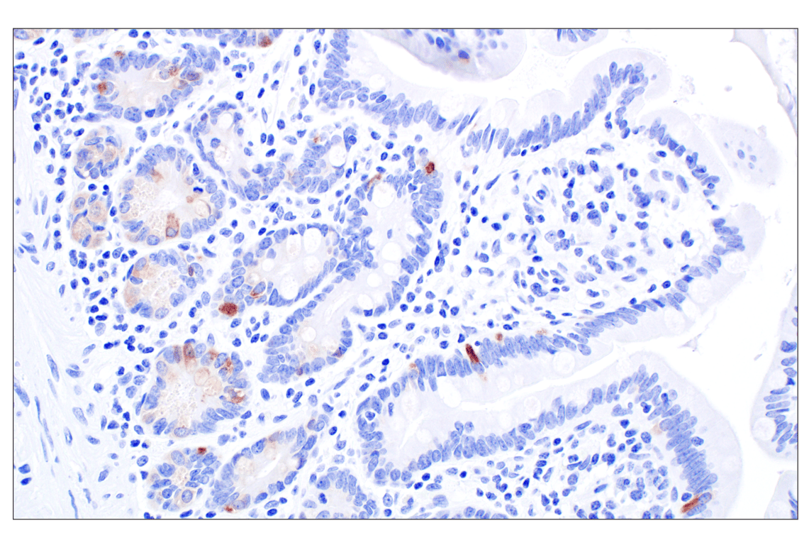 Immunohistochemistry Image 3: IGFBP2 (F3E6V) Rabbit Monoclonal Antibody