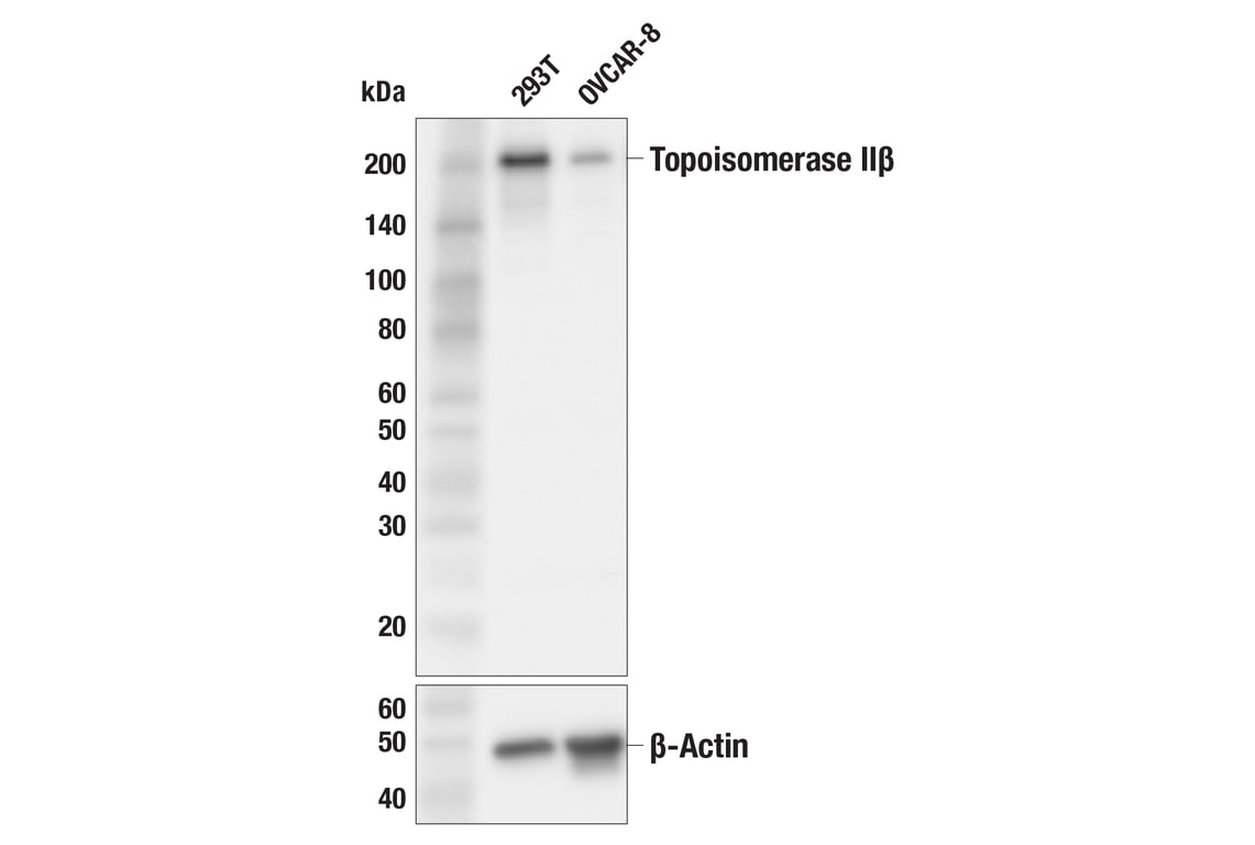 Western Blotting Image 1: Topoisomerase IIβ (F6T3T) Rabbit mAb