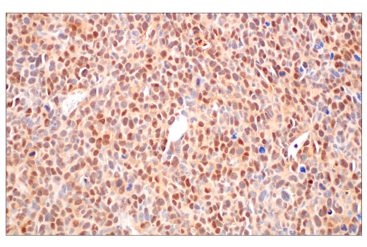undefined Image 27: CRL4/CRBN Targeted Protein Degradation Complex Antibody Sampler Kit