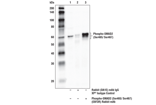 Immunoprecipitation Image 1: Phospho-SMAD2 (Ser465/Ser467) (E8F3R) Rabbit Monoclonal Antibody