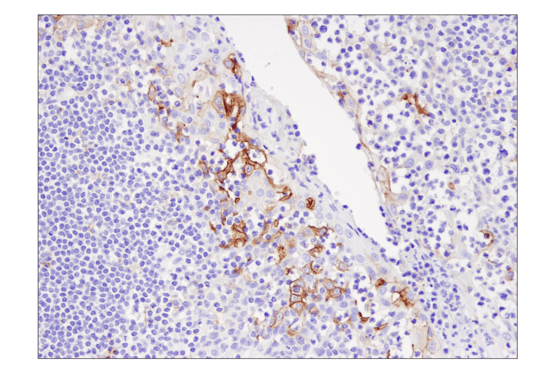 Immunohistochemistry Image 2: PD-L1 (405.9A11) Mouse Monoclonal Antibody (BSA and Azide Free)