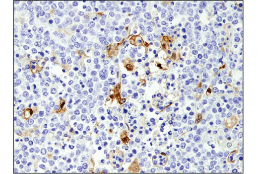 Immunohistochemistry Image 1: ARC (D7Q3G) Rabbit Monoclonal Antibody
