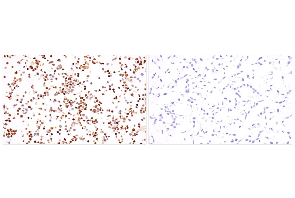 Immunohistochemistry Image 10: INSM1 (BLR272L) Rabbit Monoclonal Antibody
