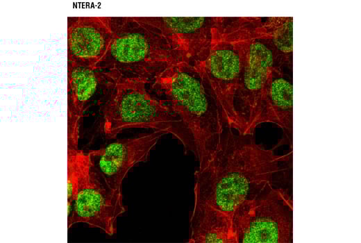 Immunofluorescence Image 1: JMJD2A (C37E5) Rabbit Monoclonal Antibody