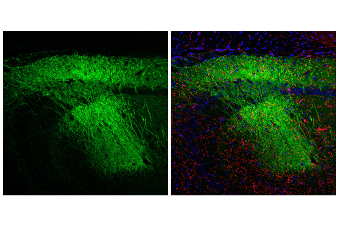 Immunofluorescence Image 1: RGS14 (E4N2Q) Rabbit Monoclonal Antibody (BSA and Azide Free)