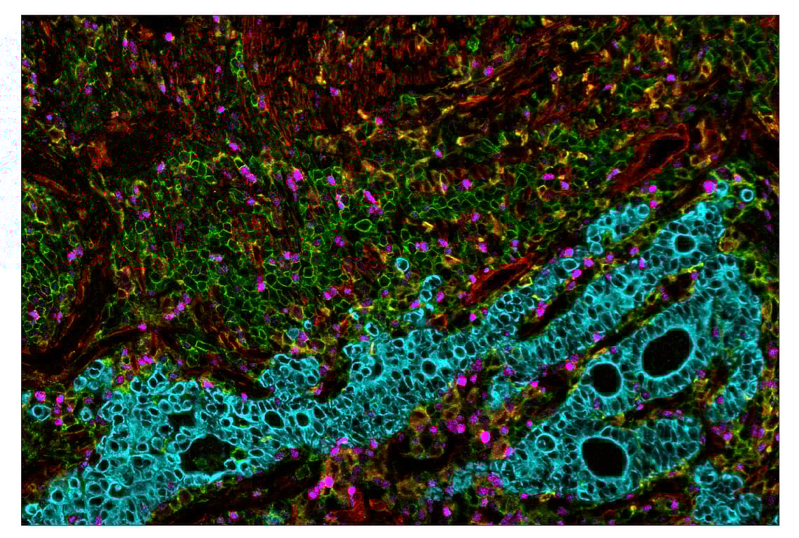 Immunohistochemistry Image 7: CD44 (E7K2Y) & CO-0030-594 SignalStar<sup>™</sup> Oligo-Antibody Pair